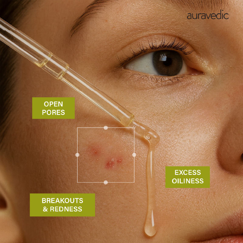 Tea Tree Oil Salicylic acid Face Serum for Acne Prone Skin Pore Minimizing Serum