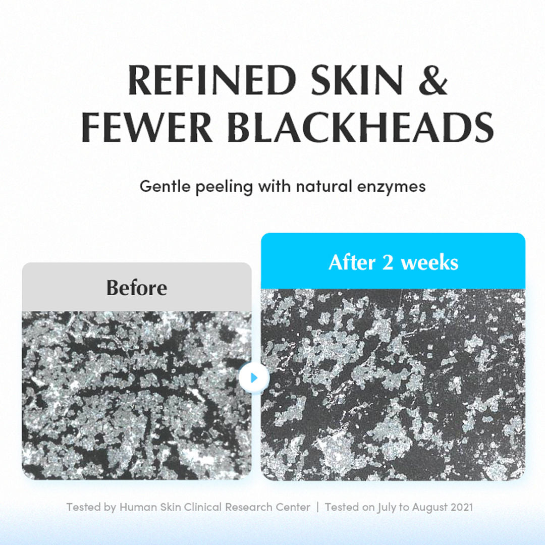 Swimming Pool Toner 5 Berry Complex & Hyaluronic Acid,Pore Refining & Gentle Exfoliation
