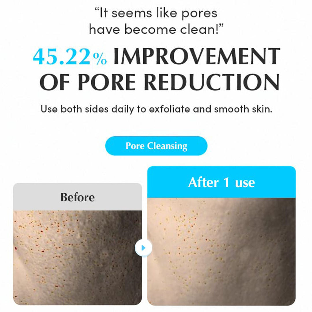 Swimming Pool Toner Pads 30pcs – Dual-Textured Pads for Pore Care & Gentle Exfoliation