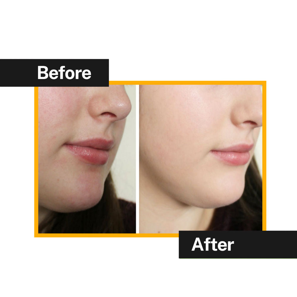 Charcoal Peel off Mask