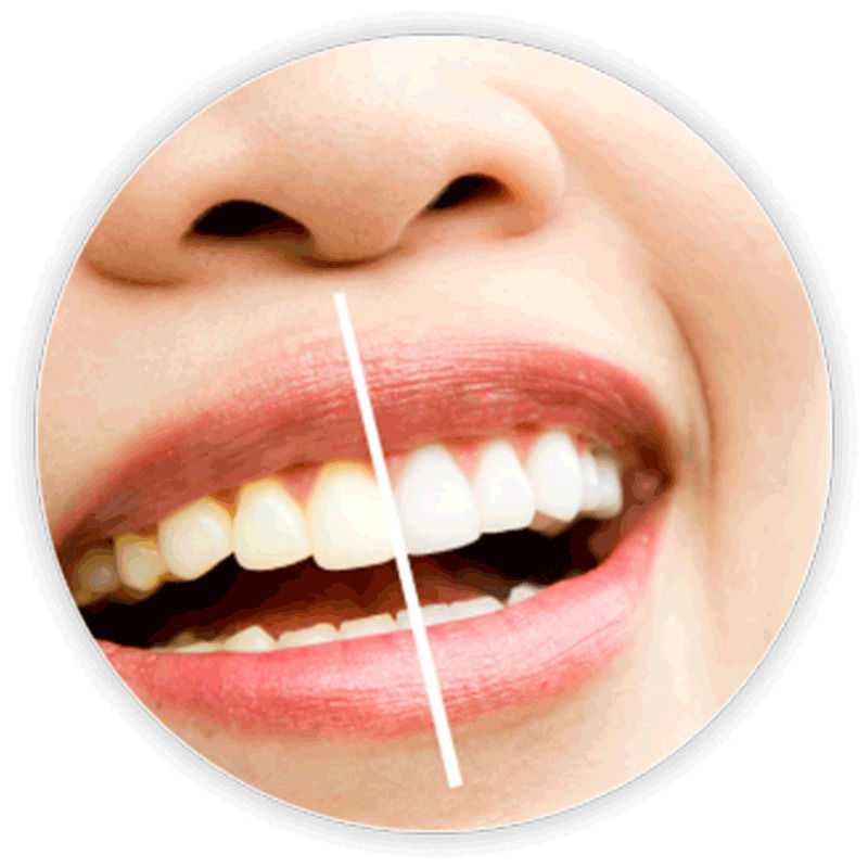 Teeth Whitening Strips + Sensitivity Strips