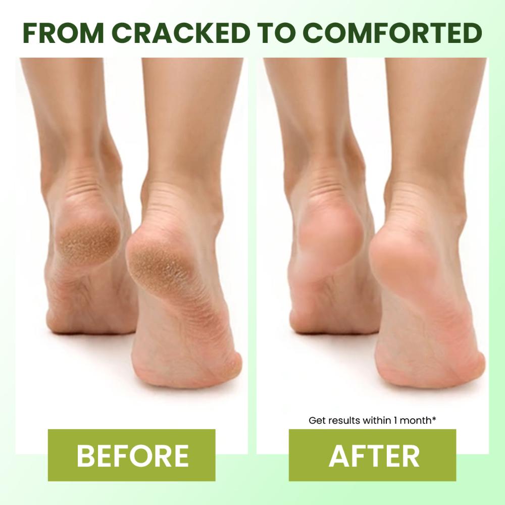 Revitalizing Foot Cream