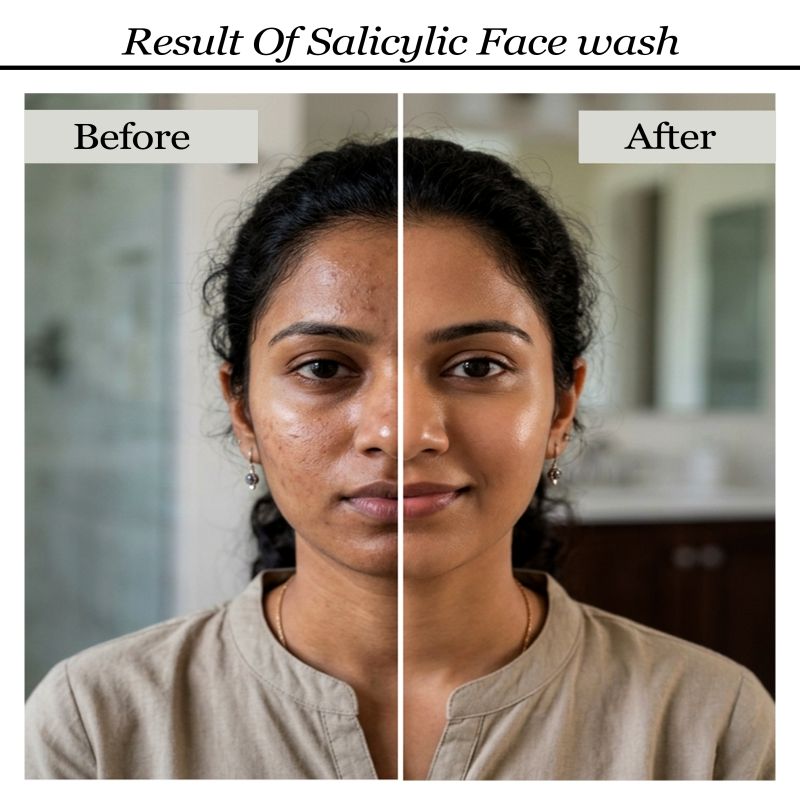 Salicylic & Neem Face Wash