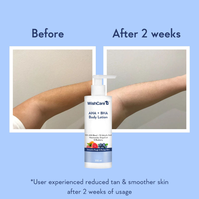 AHA + BHA Exfoliating Body Lotion for Strawberry Skin-Provides Deep Hydration & Detan Skin