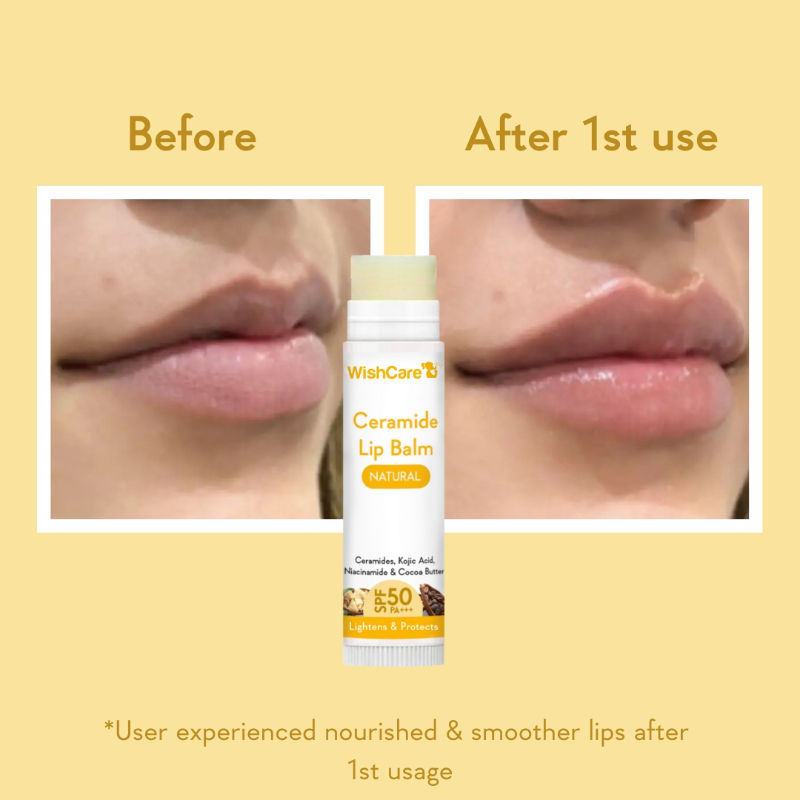 Natural Ceramide Lip Balm for Dark Pigmented Lips with SPF50 PA+++ Heals Dry & Chapped Lips