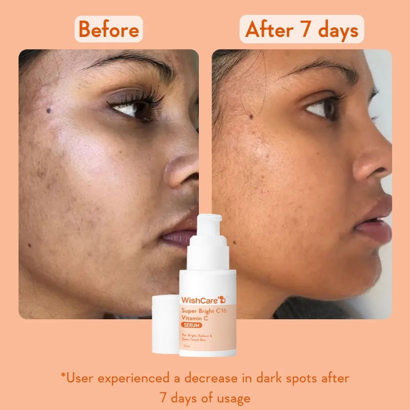 Super Bright C16 Vitamin C Face Serum for Glowing Skin- Reduces Pigmentation & Dark Spots