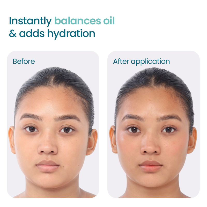 2:1:3 NMF Oil Free Water Gel Moisturizer for Oily & Acne Prone Skin with Niacinamide & Cica