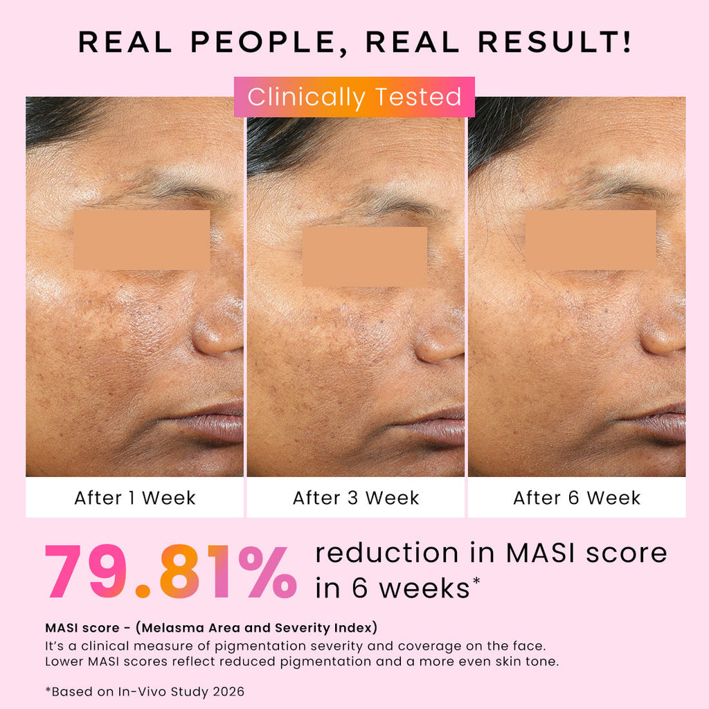 Biphasic Advanced De-Pigmentation Serum, Correct & Prevent Pigmentation In-Vivo Tested