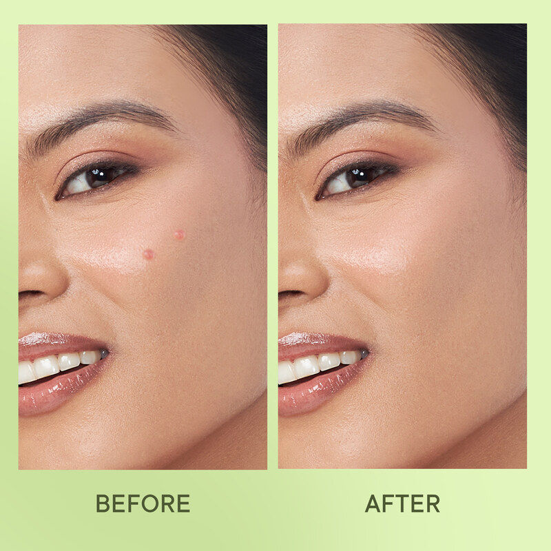 Cica & Salicylic Acid Acne Pimple Patches