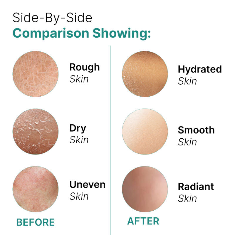 Skin Superfoods Hydrating Face Gel