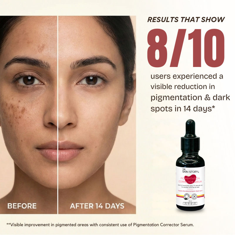Anti Pigmentation Face Serum For Brighter Skin, Dark Spots, Niacinamide Alpha Arbutin
