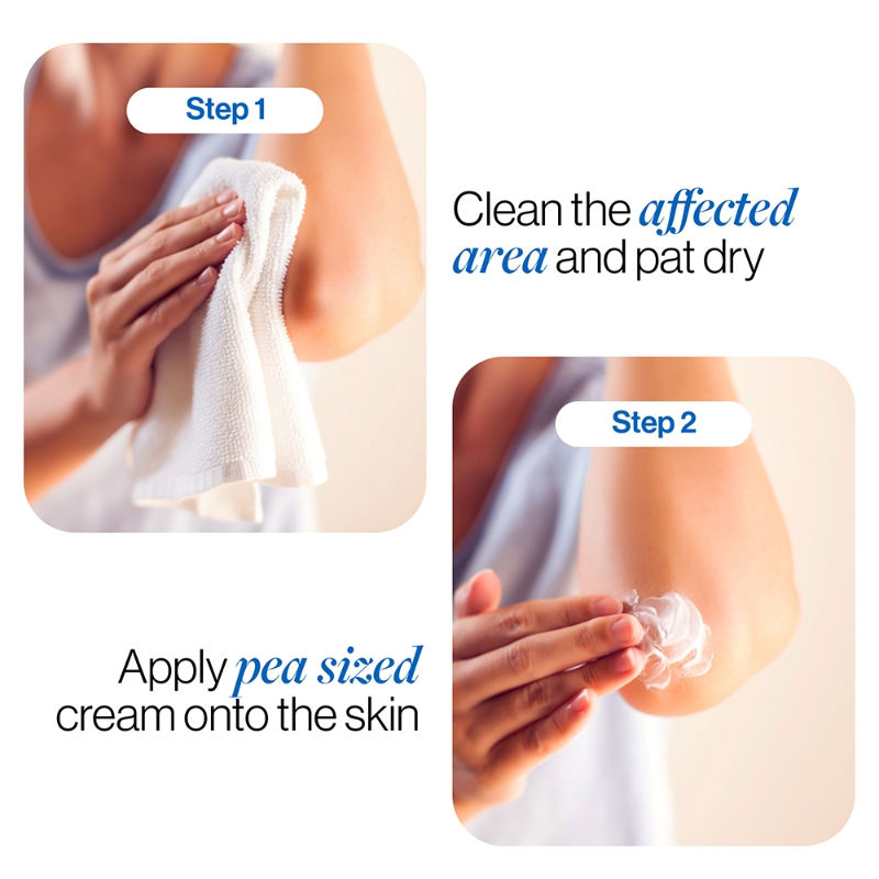 Pigmentation Removal Cream With 2.5% Lactic Acid, 2% Urea, Retinol - Treats Dark Patches
