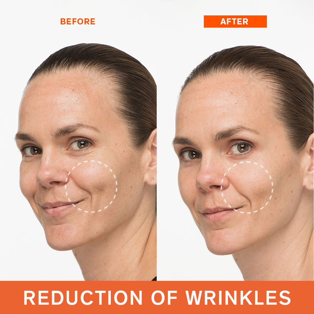 First Care Activating Serum VI