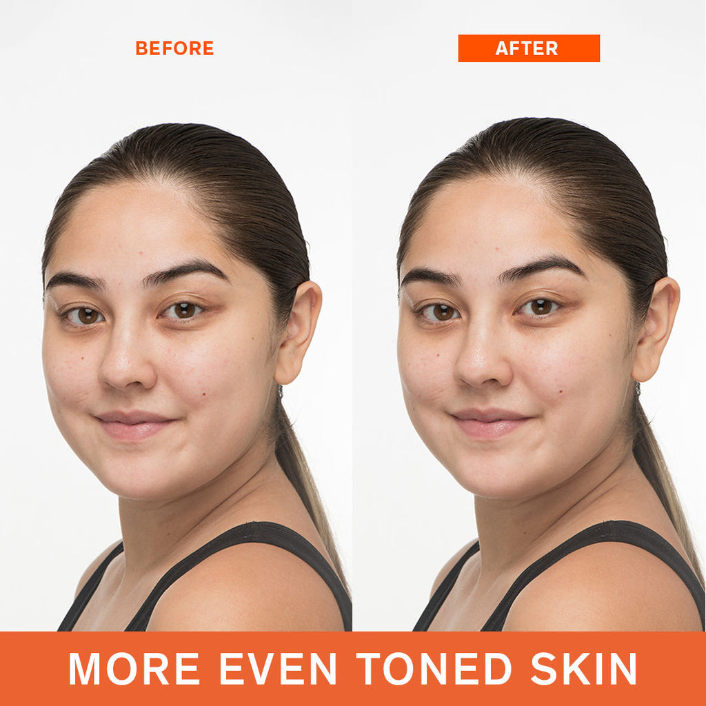 First Care Activating Serum VI