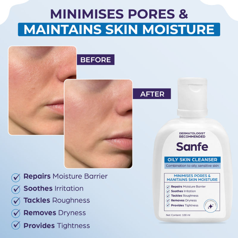Oily Skin Cleanser | For skin repair, dryness, tighter skin - For Oily, Acne Prone Skin, 100ml