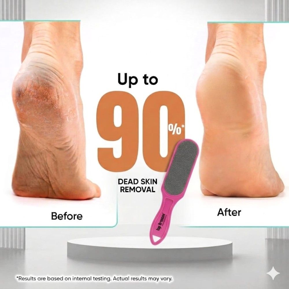 Double Sided Emery Foot File Callus, Dead Skin Remover for Smooth Pedicure Feet