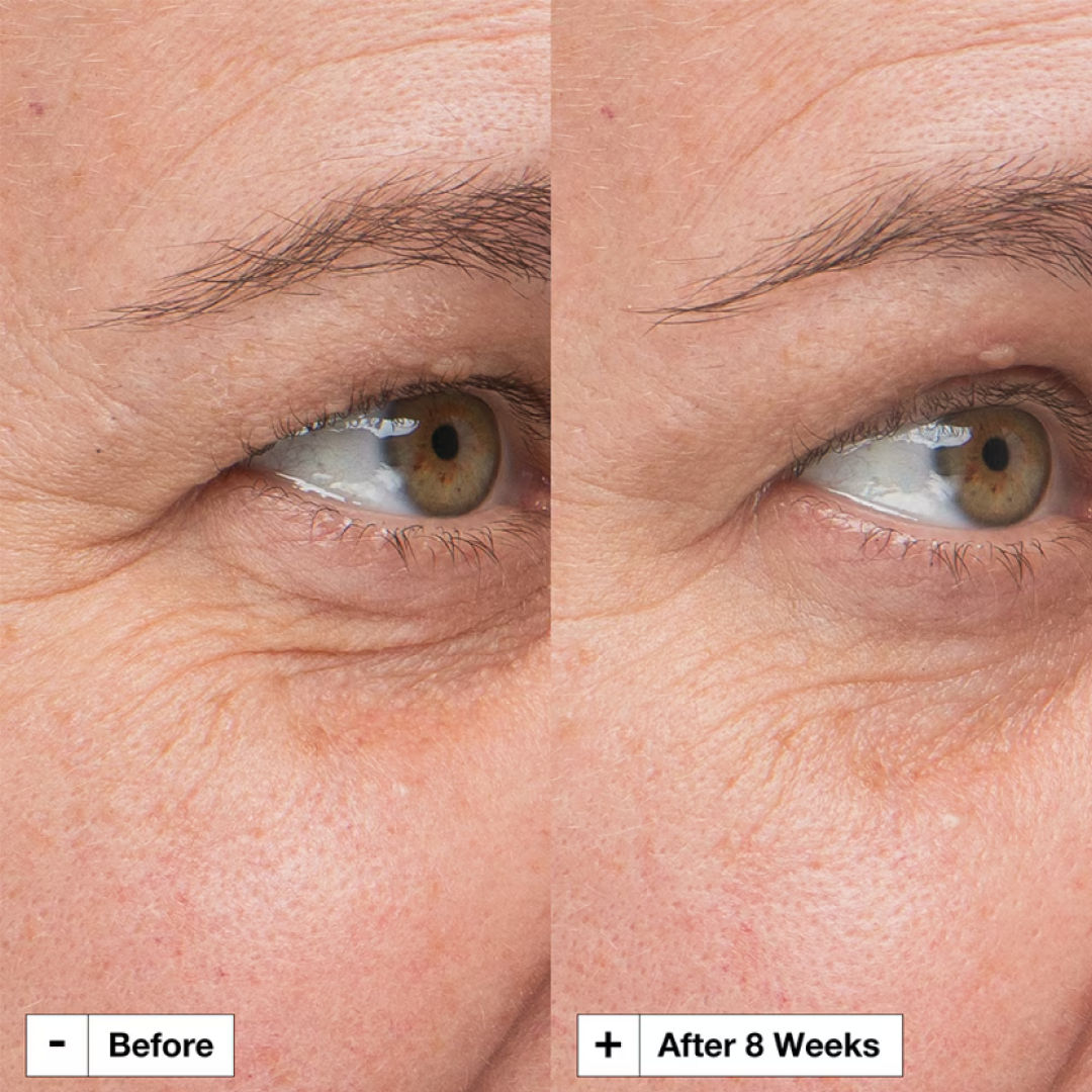 Prejuvenation Firming Bakuchiol Serum For Preventative Aging – Serum With Collagen Peptide