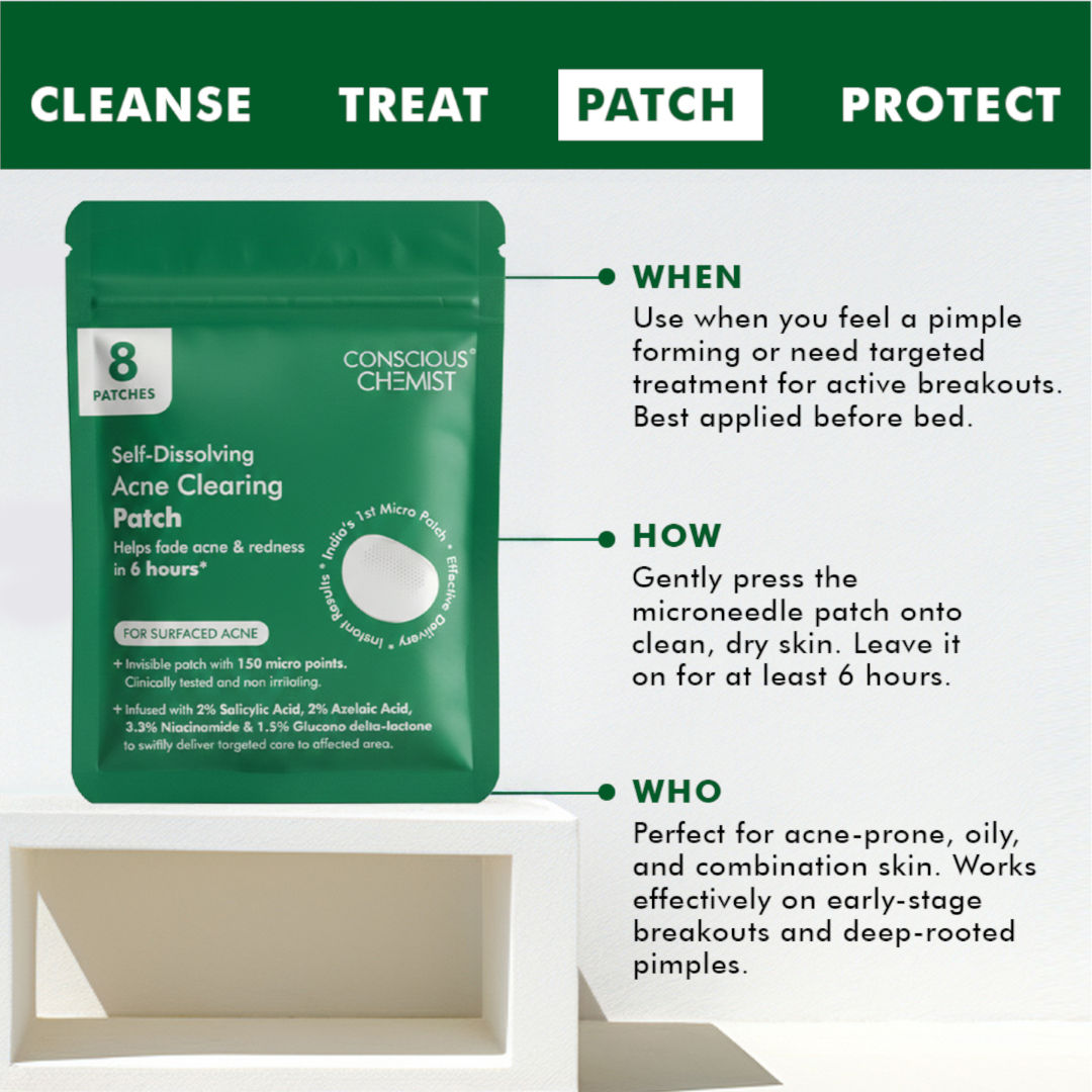 Self Dissolving Microneedle Acne Patches