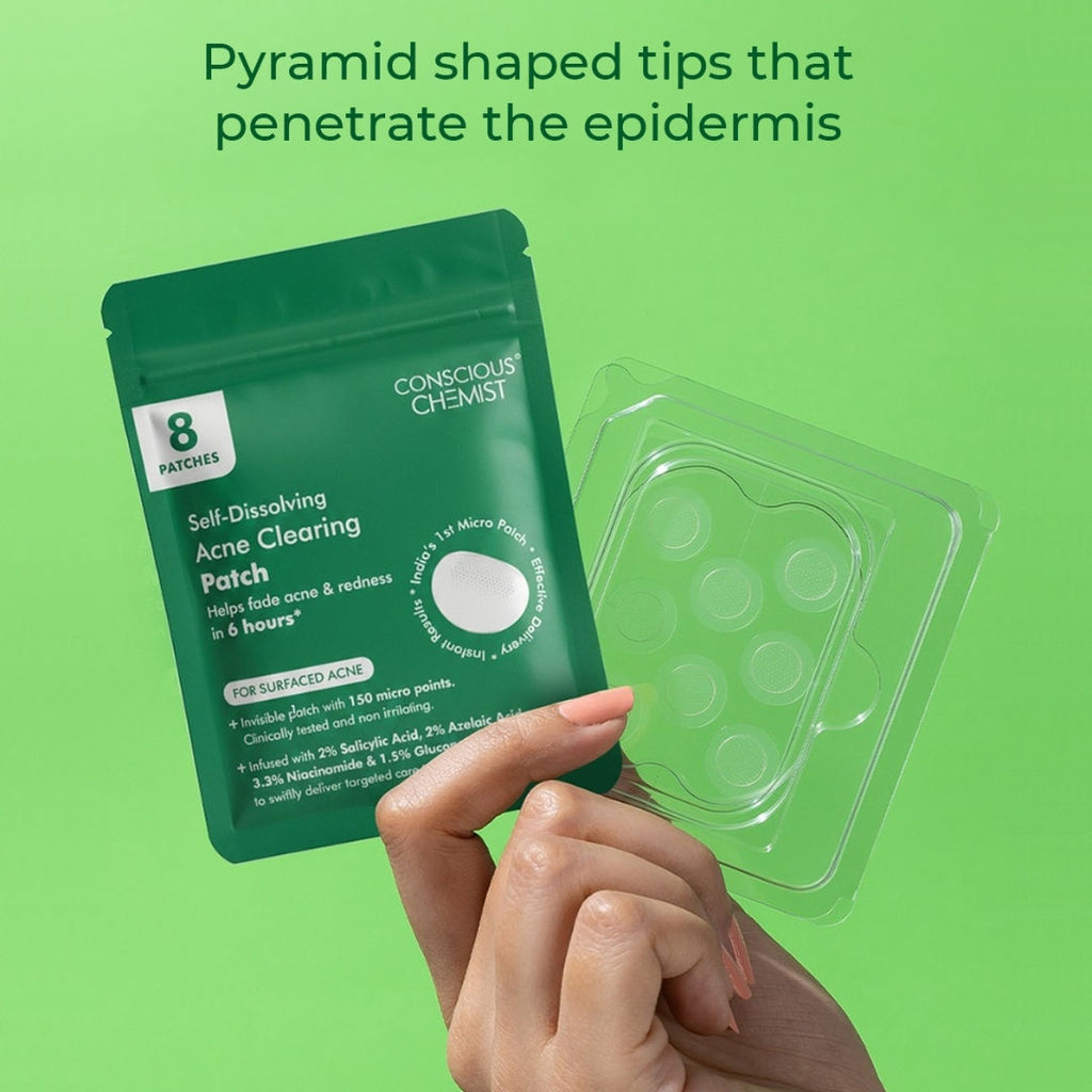 Self Dissolving Microneedle Acne Patches