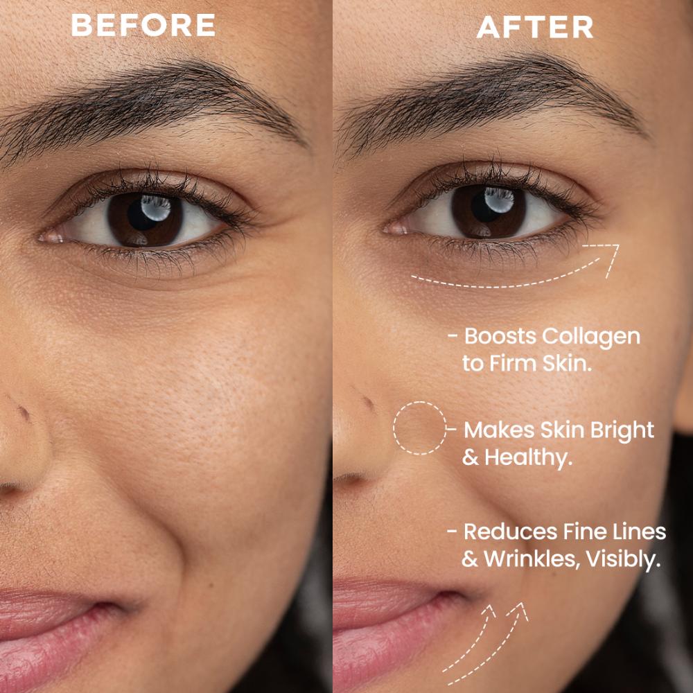 0.05% Retinal Reset, Retinol Derivative Serum for Anti Ageing, Reduces Fine Lines & Wrinkles