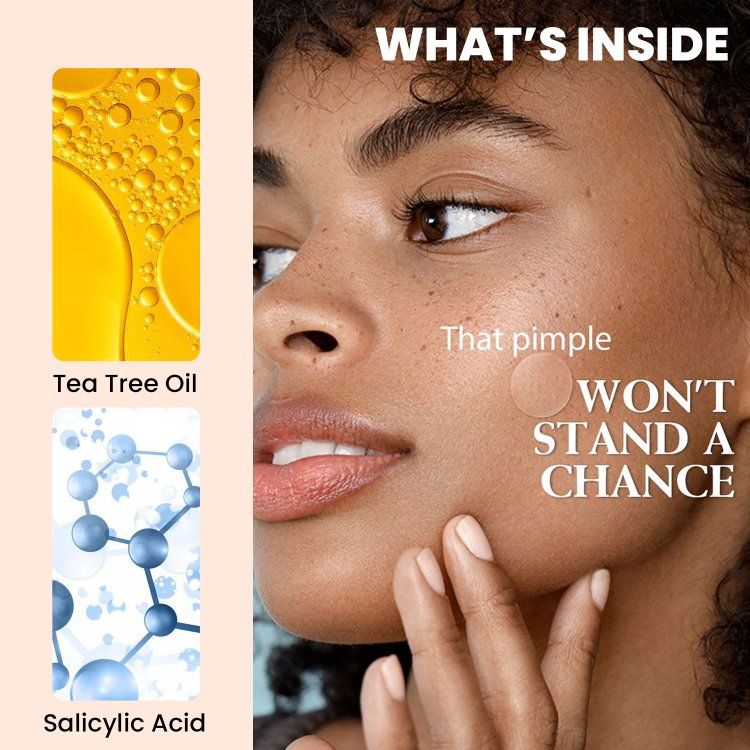 Acne Pimple Patches