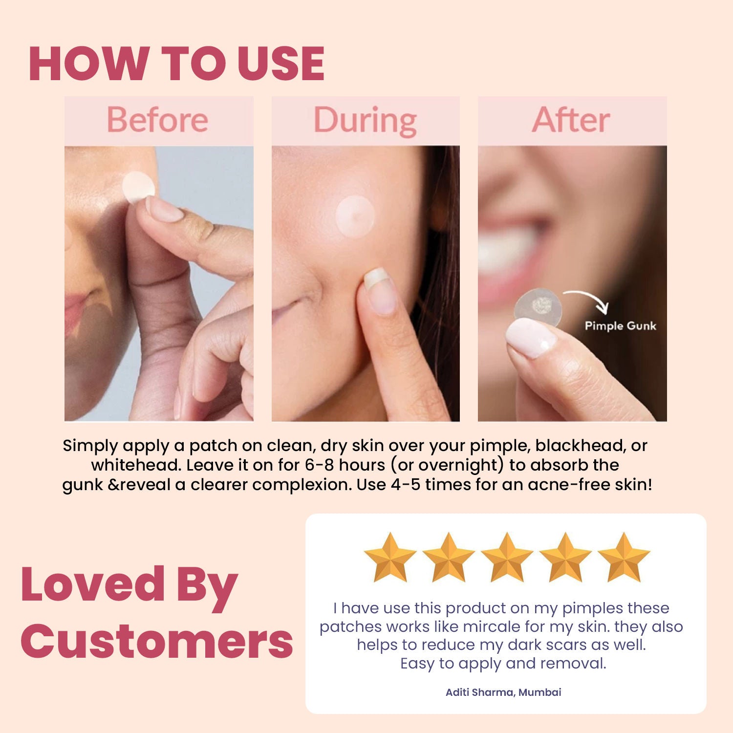 Acne Pimple Patches