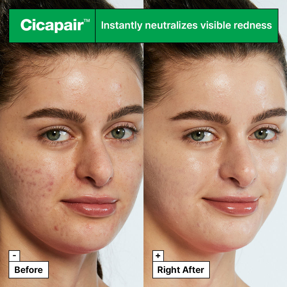Cicapair Tiger Grass Color Correcting Treatment With Cica Extracts & Niacinamide (Dermatologist Tested)