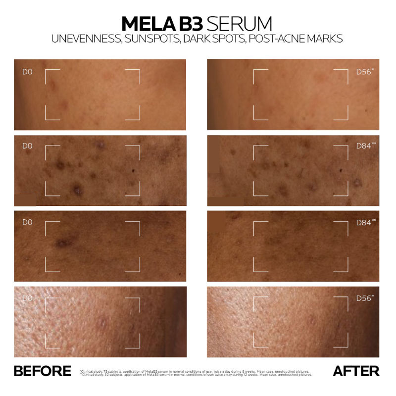 Mela B3 Serum, For Anti-Dark Spots & Pigmented Skin with Melasyl + 10% Niacinamide
