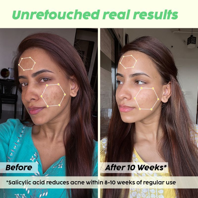 0.1% Salicylic Acid Jamun Mattifying Lightweight Sunscreen SPF50+ PA+++ UVA, UVB Shield