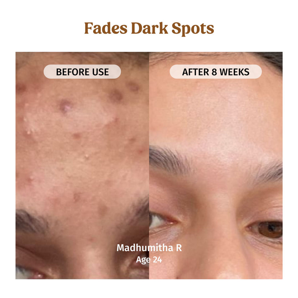 Milk Drops Skin Brightening Serum With Rice Milk, Marine Algae Extract & Alpha-Arbutin