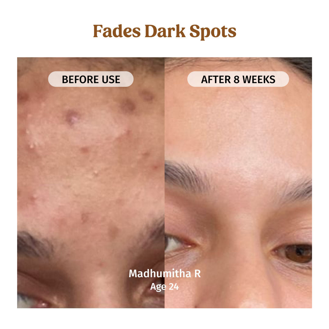 Milk Drops Skin Brightening Serum With Rice Milk, Marine Algae Extract & Alpha-Arbutin