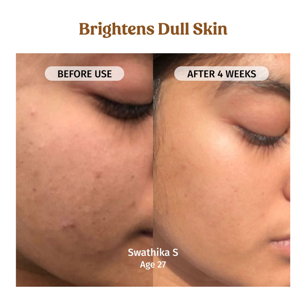 Milk Drops Skin Brightening Serum With Rice Milk, Marine Algae Extract & Alpha-Arbutin