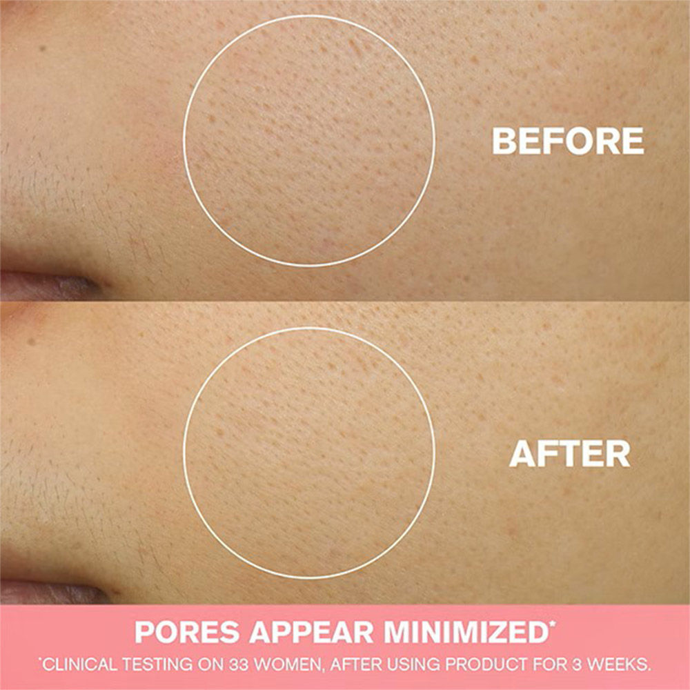Nutritious 2-In-1 Foam Cleanser with Niacinamide for Pore Minimization (For Oily Skin)
