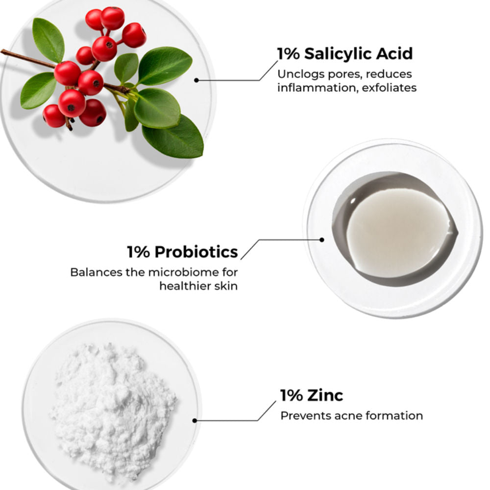 Salicylic Acid Liquid Moisturizer for Oily & Acne Prone Skin Visible Acne Reduction in 1 Week