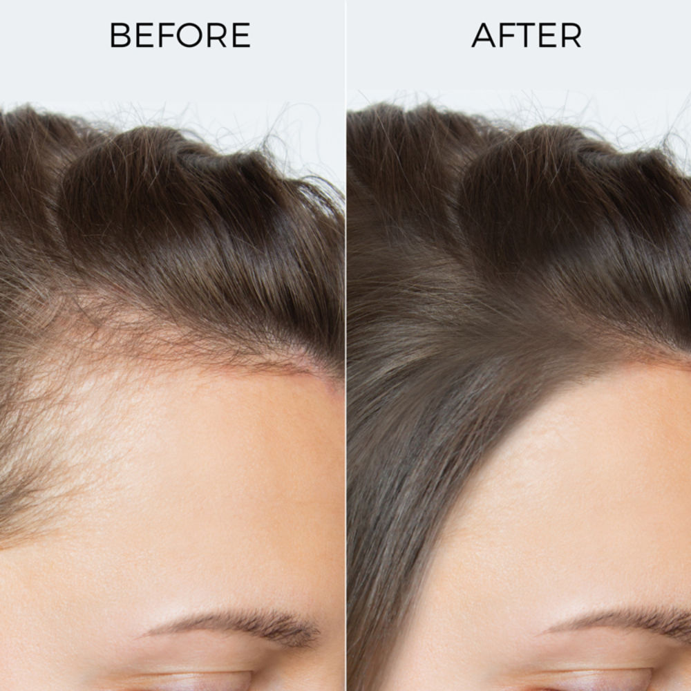 Pure Rosemary Essential Oil for Hair Growth & Scalp Nourishment