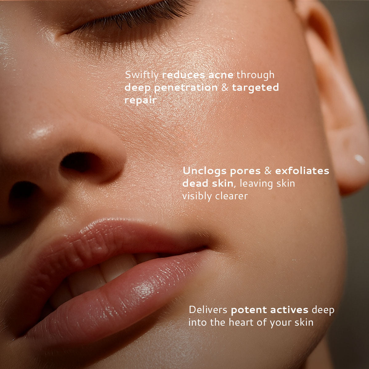 2% Salicylic Acid Face Serum for Active Acne & Pores with Advanced NightRenew Complex