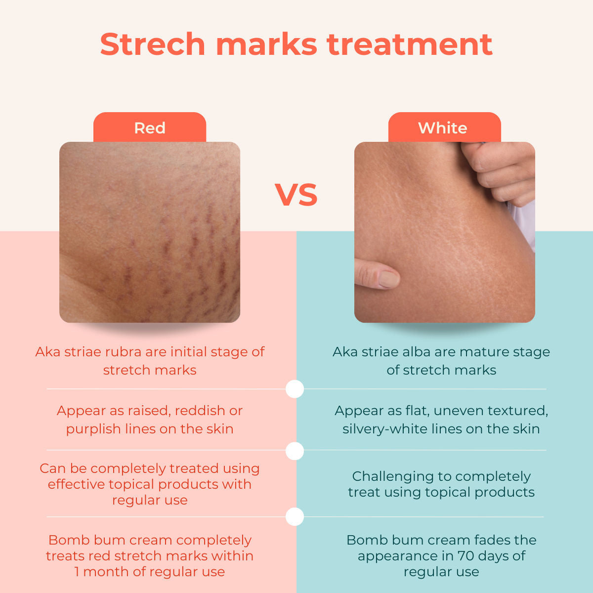 Bomb bum cream for Stretch Marks + Cellulite