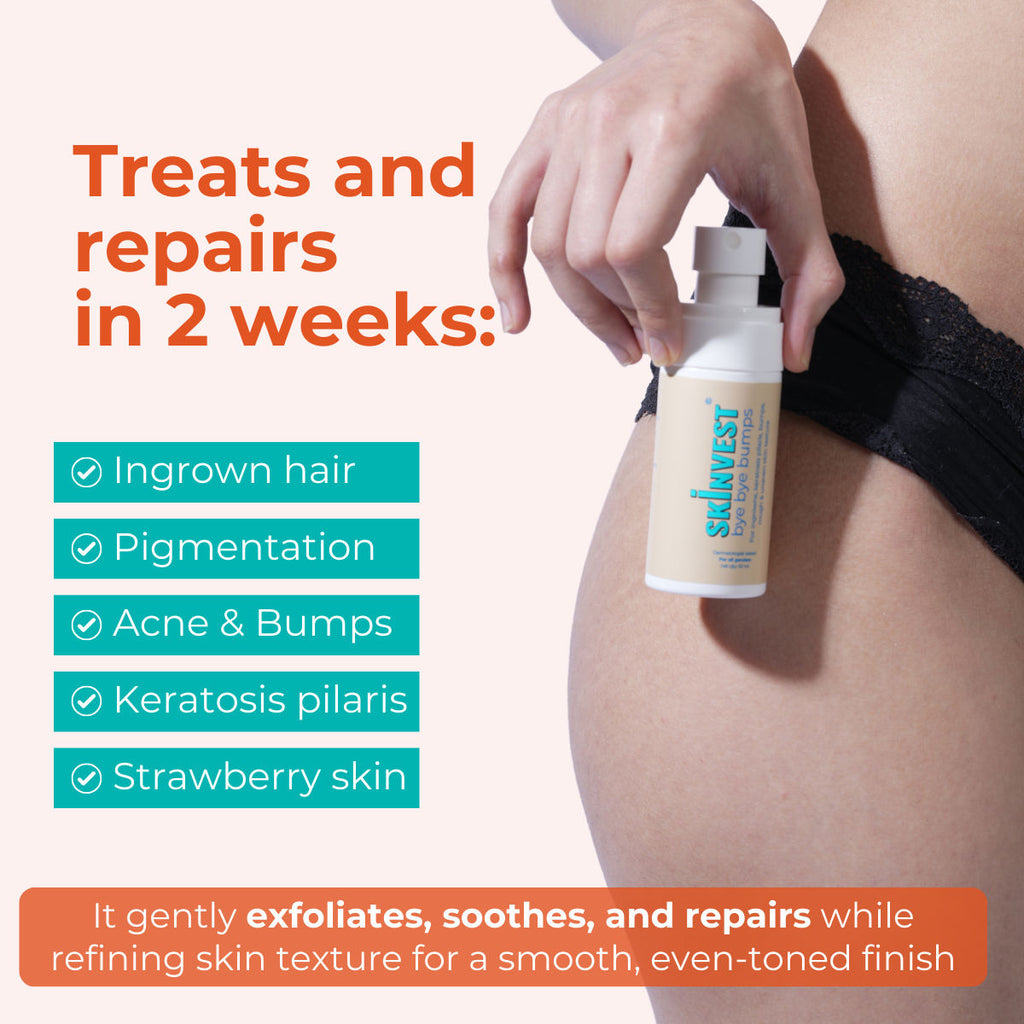 Bye Bye Bumps - Exfoliating Body Mist