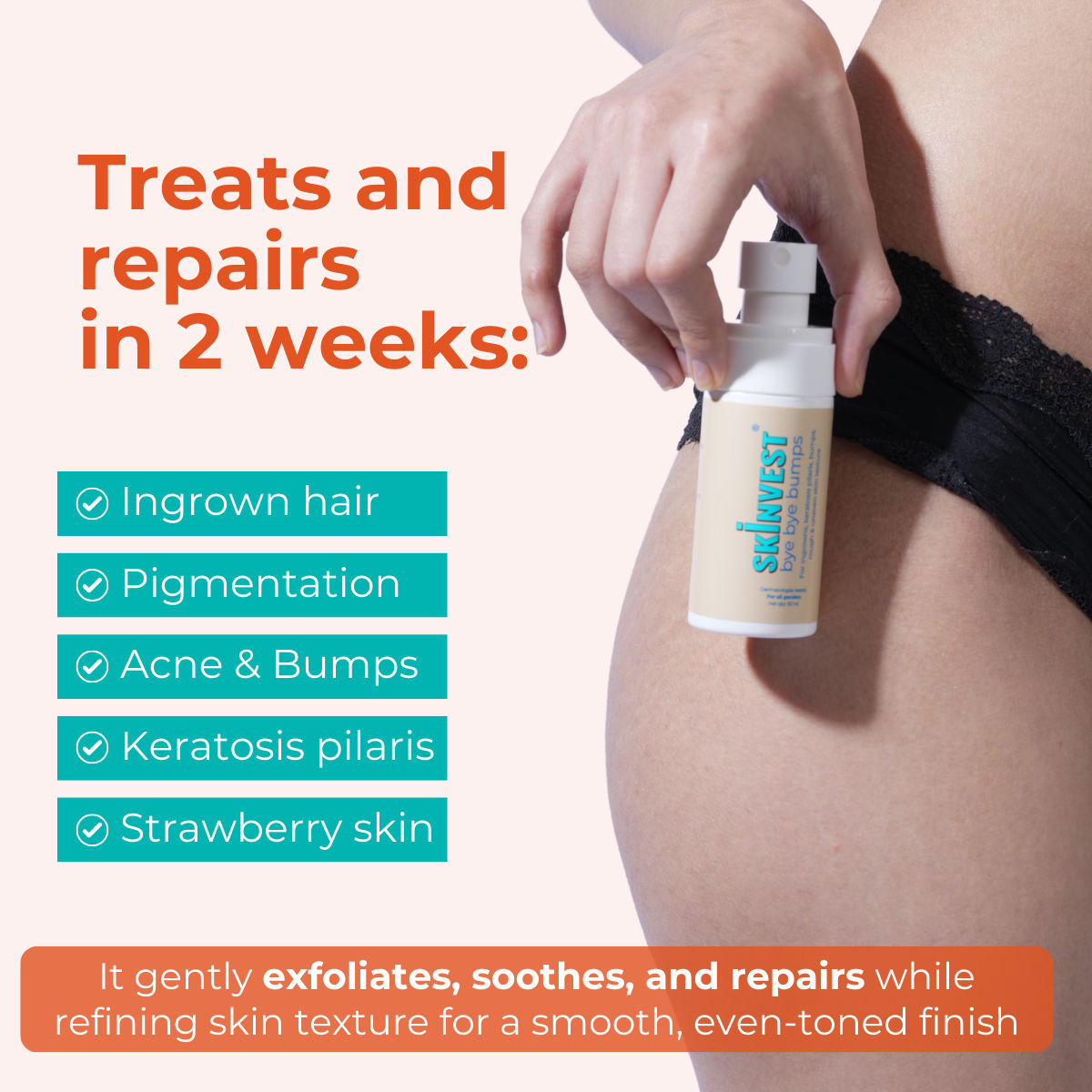 Bye Bye Bumps - Exfoliating Body Mist