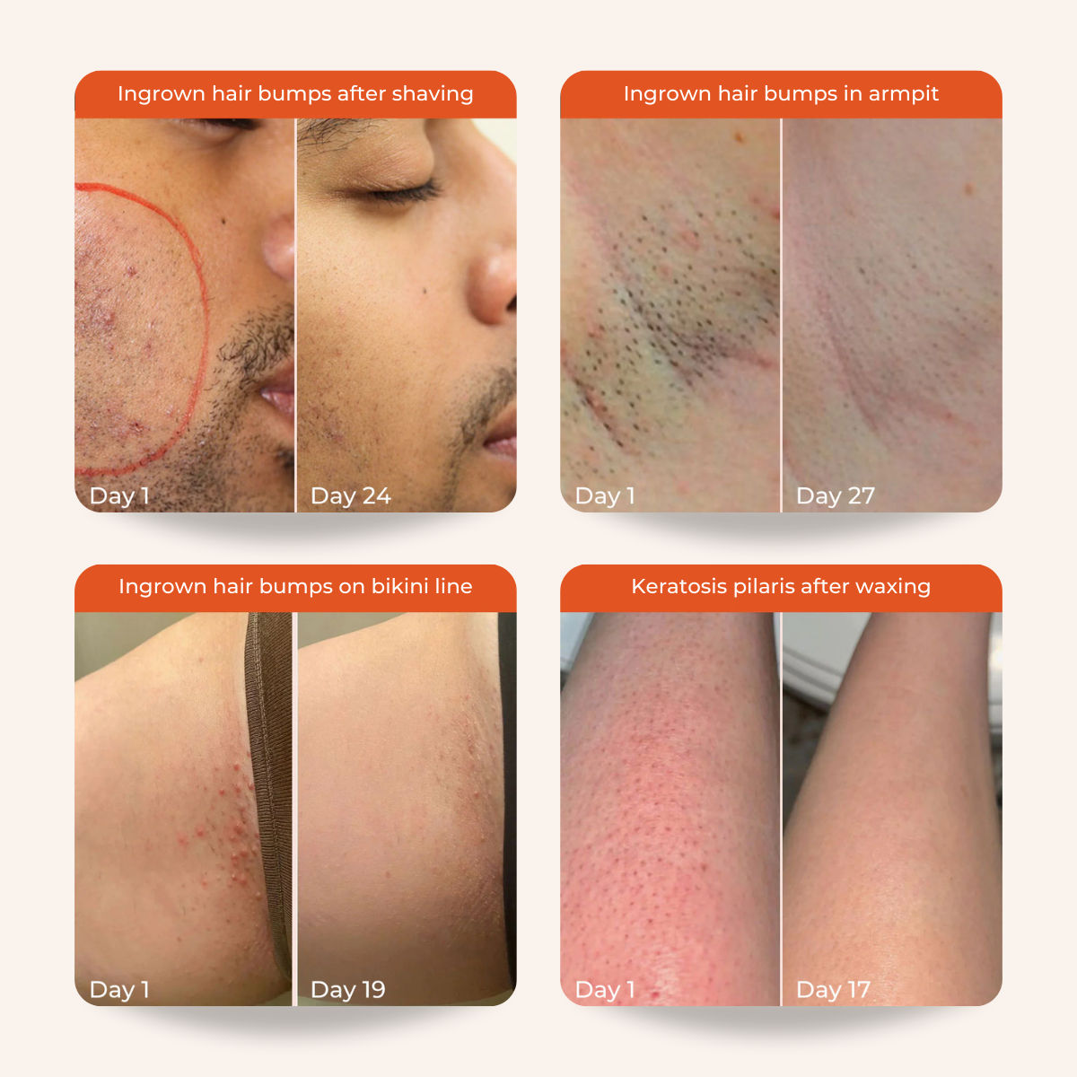 Bye Bye Bumps - Exfoliating Body Mist