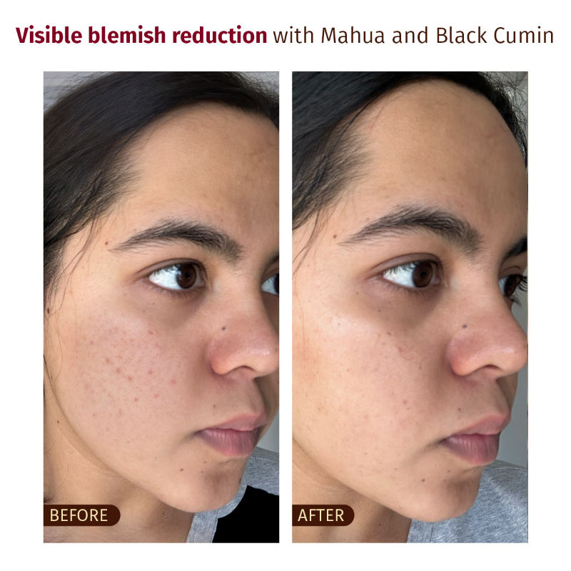 Gentle Cleansing Splash | Foaming Face Wash for Glowing, Blemish-Prone & Sensitive Skin