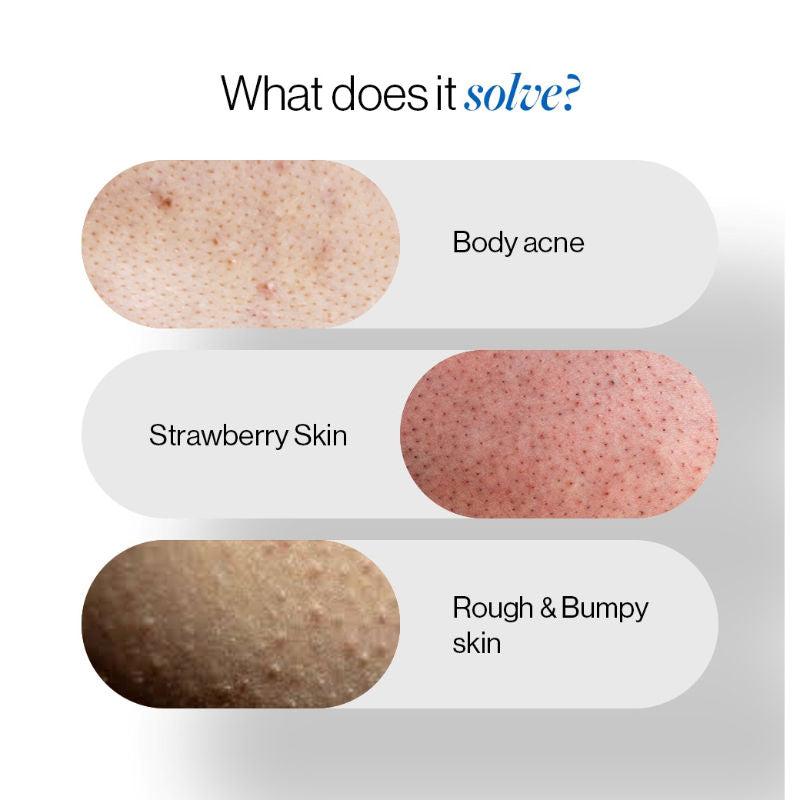 1% Salicylic Acid Body Wash, Treats Body Acne & Strawberry Skin - Exfoliating Shower Gel