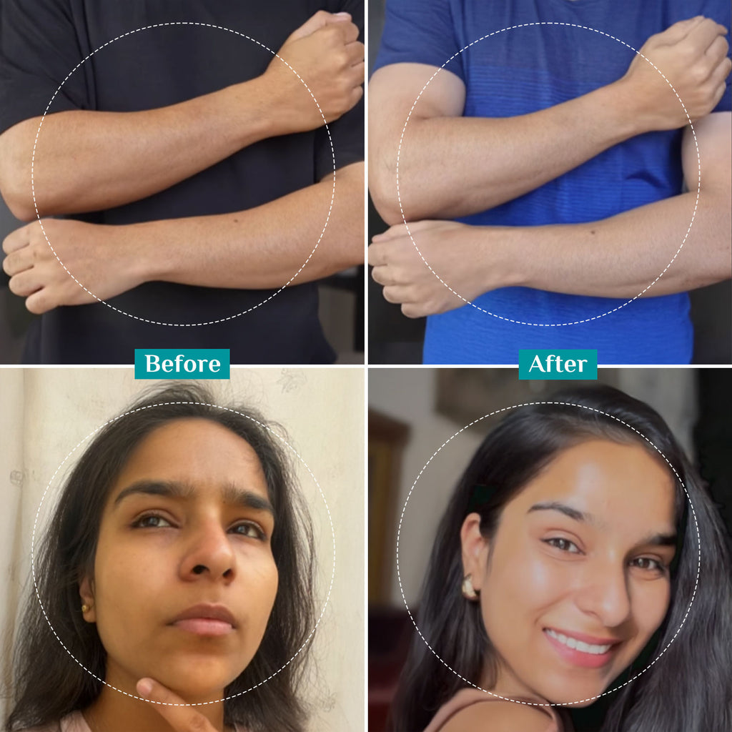 25% AHA + 2% BHA + 5% PHA Peeling Solution Face Serum