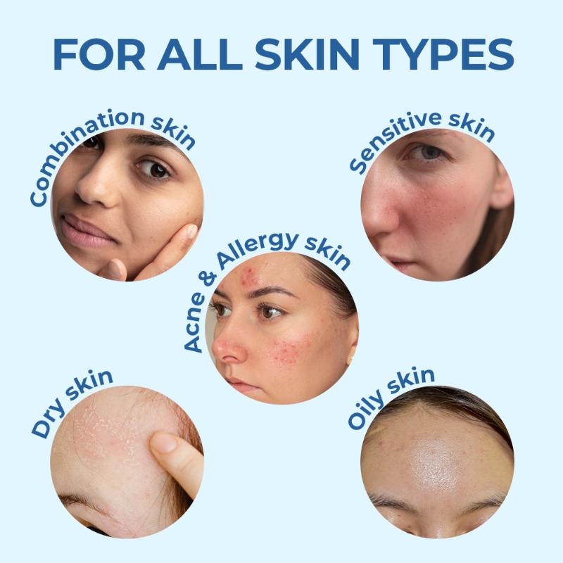 Moisturising Face & Body Lotion For Dry, Aging, Wrinkles, Acne, Red Skin With Vitamin E