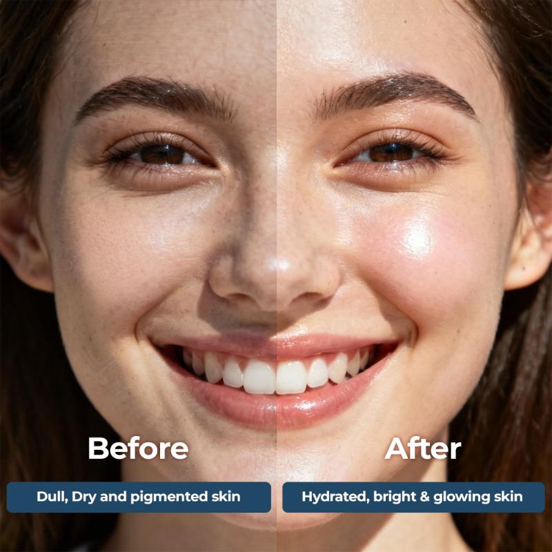 Moisturising Face & Body Lotion For Dry, Aging, Wrinkles, Acne, Red Skin With Vitamin E