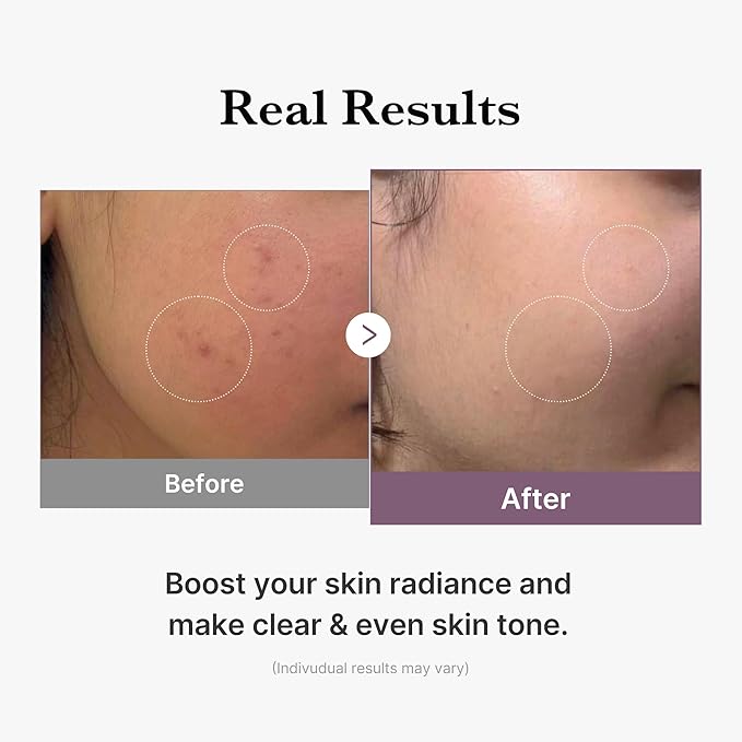 Age-R Glutathione Glow Toner