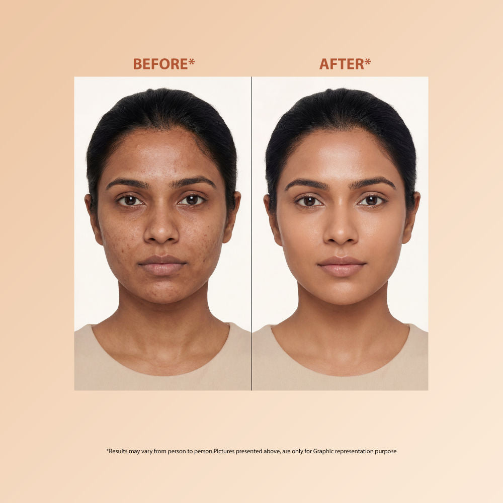 Skin Perfecting Niacinamide Serum