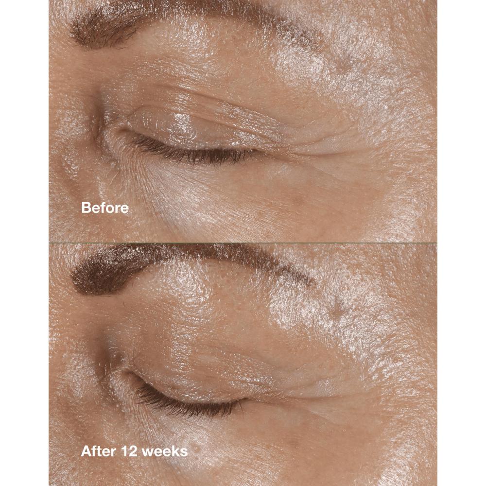 Smart Clinical Repair Wrinkle Correcting Eye Cream With Peptides
