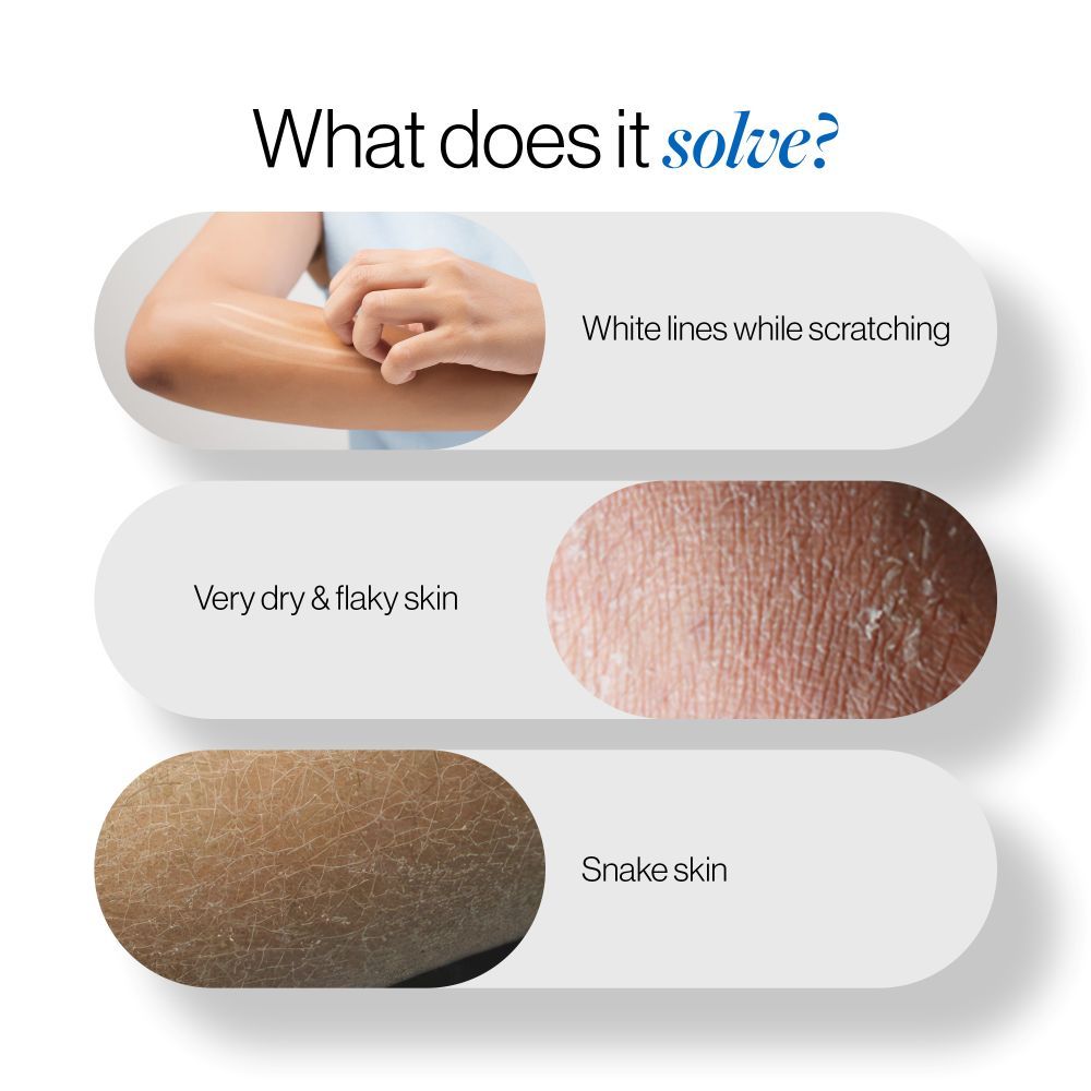 20% Urea Body Lotion - Advanced Formulation