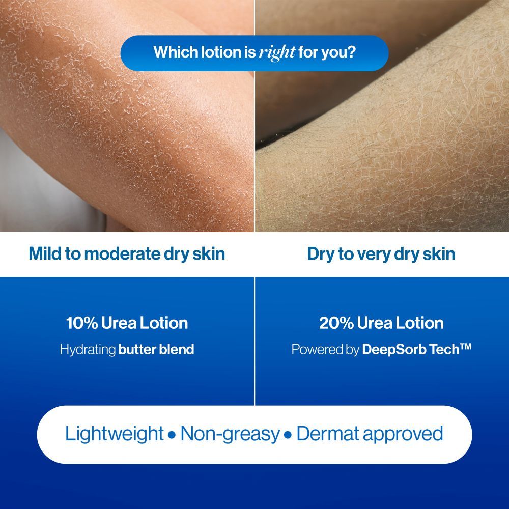 20% Urea Body Lotion - Advanced Formulation
